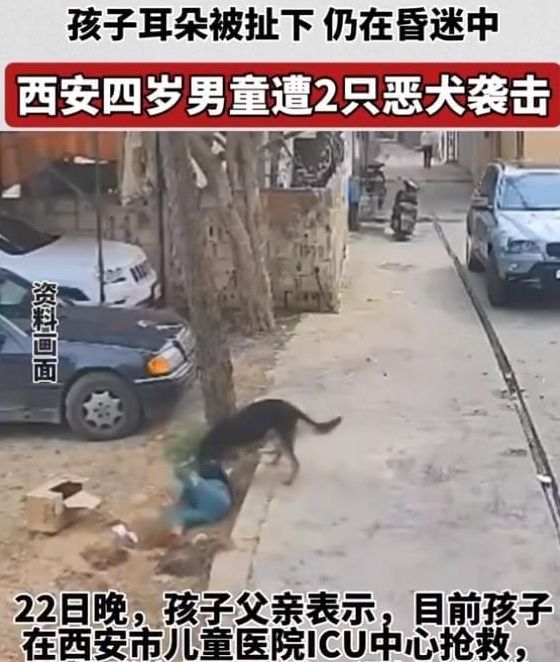 西安男童遭恶犬袭击